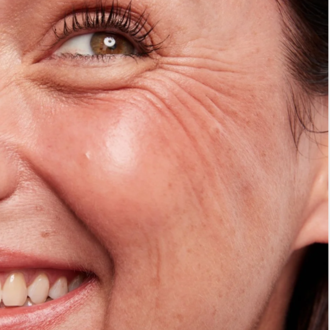 Depois dos 40, ainda vale fazer cirurgia a laser?