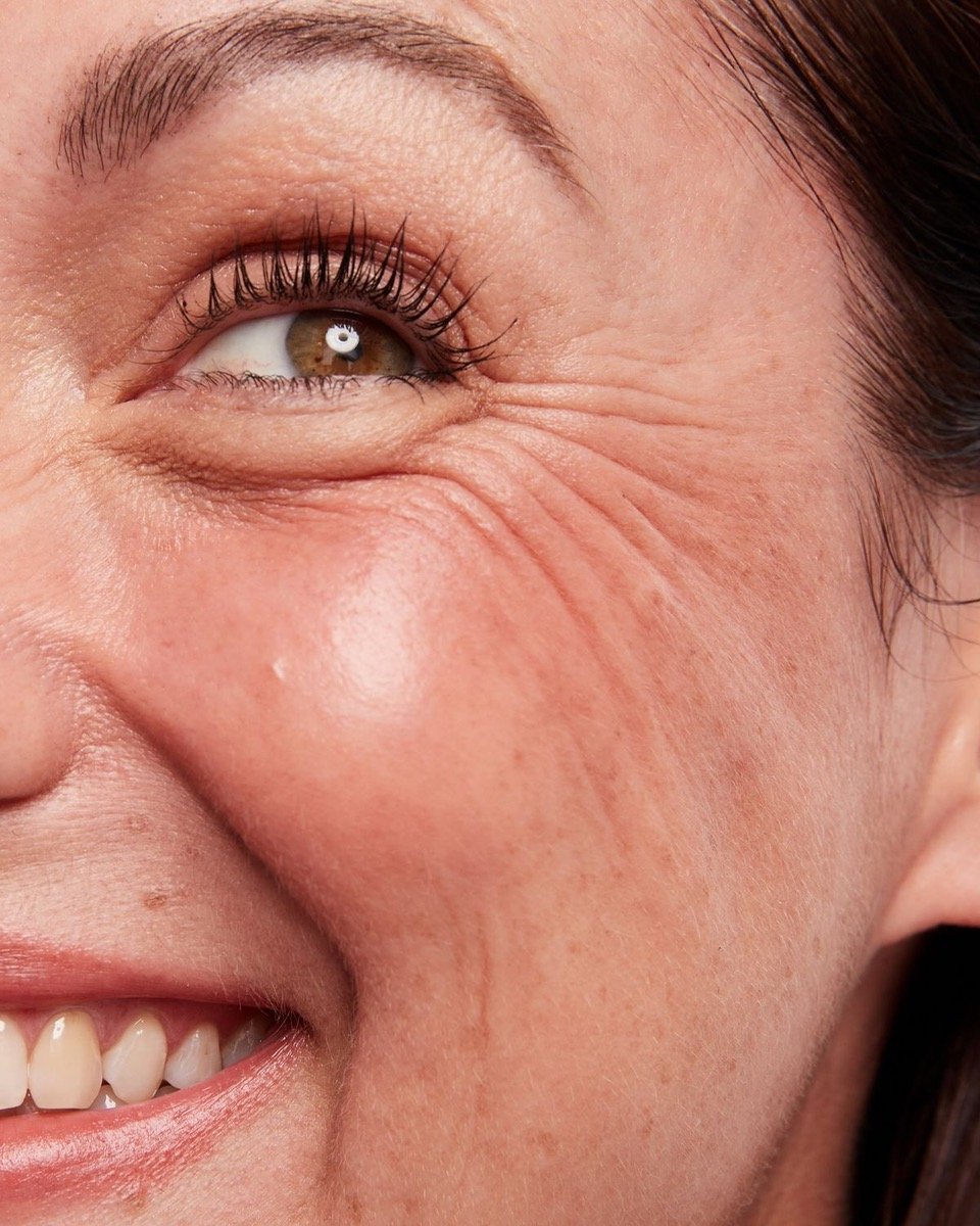 Depois dos 40, ainda vale fazer cirurgia a laser?